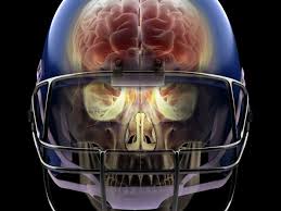 Many people believe you have to lose consciousness to have a concussion. Super Bowl 2020 Football Concussions The Link Between Head Injuries And Cte Explained Vox