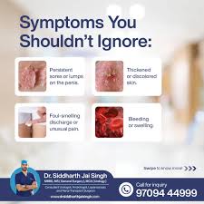 Image result for Penile Cancer