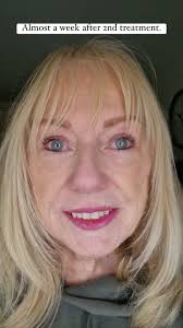 Let's welcome our new followers. If you'd like info about joining a  supportive community & attend our events click below 👇  www.thecheshireclub.com/membership www.thecheshireclub.com/mentor  www.thecheshireclub.com/events-for-your-diary Denise Beckett ...