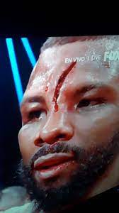 Legendary cutman stitch duran gives his thoughts on the treatment of badou jack's horrific cut. Spoiler Massive Cut On The Loser Of Badou Jack Vs Marcus Browne Boxing
