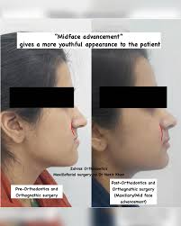 Zahra Khalid (@zahras_orthodontics) • Instagram photos and videos