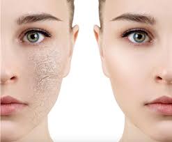 6 cách làm đẹp da mặt bằng sữa chua đơn giản nhưng hiệu quả