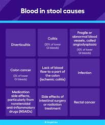 Image result for Blood in stool