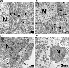 Apoptosis is programmed cell death (pcd) or cellular suicide, necrosis involves stress induced swelling and lysis. Mechanisms Of Neuron Death Necrosis Apoptosis Autophagy After Brain Ischemia Sciencedirect