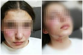 Majka pretučene djevojčice pozvala na prosvjed: 'Danas je to moje dijete,  sutra može biti neko drugo'