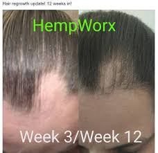 Some women, because of doing the wrong things with their braids, actually end up losing hair. Cbd Oil Helps With Hair Growth Braids N Beauty Facebook