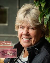 CONGRATULATIONS 🙌 👩🏼‍🎓 Our very own Dr Lauren Willson, has just  completed her Level 7 Postgraduate Diploma in Periodontics 🦷. Lauren has  dedicated many hours to enhancing her expertise in periodontal care,