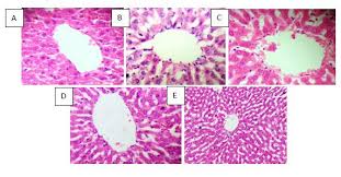 Image result for Rhaphiostylis beninensis