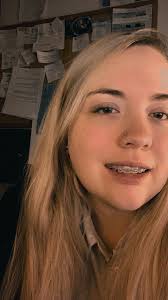 Can you edit my wedding photo?