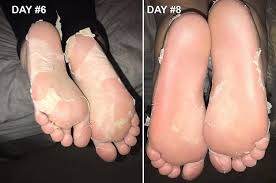 I found reapplying every three days worked the best to keep my feet healthy even . 18 Things That Ll Help Solve Your Dry Skin Problems