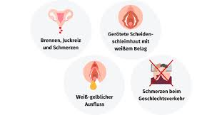 Scheidenpilz Symptome Behandlung Vorbeugung Gesund Bund De