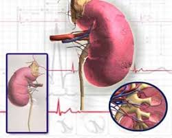 Kidney Surgery India Cost Kidney Surgery Kidney Mumbai Delhi India