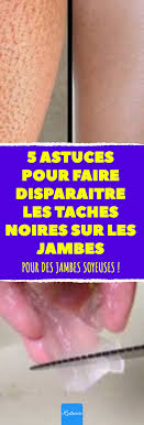 5 Astuces Pour Faire Disparaitre Les Taches Noires Sur Les Jambes Pour Des Jambes Soyeuses Soin Peau Hydrate Jambes Soyeuses Taches Noires Gommage Jambe