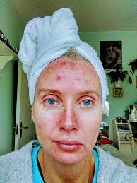 Day 6 Feels like I've shaved my...