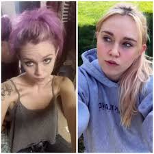 Recovery from anorexia and addiction