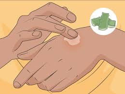 Mar 01, 2013 · gun shot residue, or simply gsr, is a means of testing for the presence of certain materials on the hands and clothing of a subject in hopes of determining that this individual may have discharged a firearm. How To Treat A Hot Glue Burn