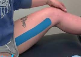 Se utiliza para proporcionar un soporte externo, fuerte y ligero, que ayuda a prevenir las lesiones y acelerar la recuperación para diferentes lesiones. How To Kinesiology Tape For Groin Pain Sportstrap
