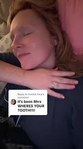 Replying to @freckle face No longer spitting through my gap!  #rebeccasuewatson #fyp #foryoupage