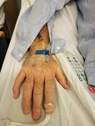 Unlike Traditional Hospital Gowns Mijamaz Medical Pajama Accommodates Intravenous Lines Anywhere On The Body Withou Hospital Gown Intravenous Intravenous Line