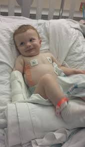 Been in the group for a month or so for my son to get different tips on his new normal. He has a Symes Amputation, was done when he was 4. He