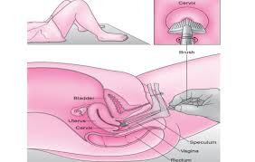 Stirile zilei din sănătate : Doctor PeÈeanu Valentin Cabinet ObstetricÄ Ginecologie Posts Facebook