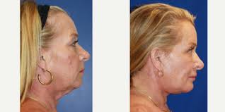 Gregory M. Casey MD, DDS, FAACS, Board Certified Oral & Maxillofacial  Surgeon