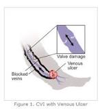 Image result