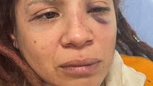 Fundraiser for Adriana Alvarez by Oscar Alvarez : Help for Momma bear  injured defending family