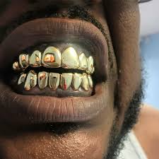 Hours may change under current circumstances 14 Karat Gold Grillz 95 Per Tooth