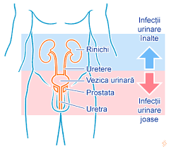 Coli, unii oameni sunt mai expusi riscului decat altii. Infectia Urinara