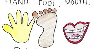 Cox a16 abbreviation stands for coxsackie virus a16. Hannahrayyan Shoppe Alternatif Rawatan Hand Foot Mouth Disease Hfmd