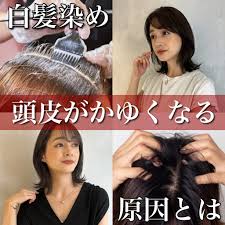 白髪染め 頭皮 かぶれ