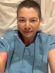 Hi All. I just woke. I had a major complication this morning as the hook  wire migrated to my chest wall muscle … I was in so much pain they had to