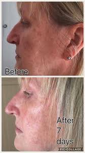 2 apa itu intrinsic youth? Trulum Skincare Fitness With Ulrika