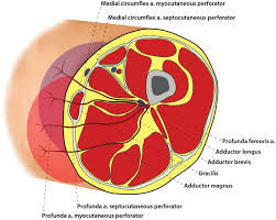 Detailed anatomy (superior part) this webpage presents the anatomical structures found on thigh mri. Cross Section Of Upper Thigh Perforators From The Medical Circumflex Download Scientific Diagram