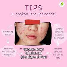 New The 10 Best Makeup Ideas Today With Pictures Bingung Jerawat Noda Hitam Bekas Jerawat Gk Ilang Ilang Udah Cob Jerawat Produk Jerawat Perawatan Kulit