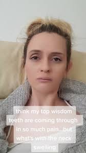 Rachel Wisdom Teeth Dr Horowitz