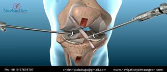 Pin On Arthroscopy