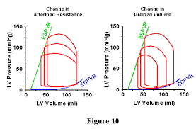 Image result for Afterload