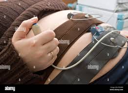 Image result for Contraction Stress Test