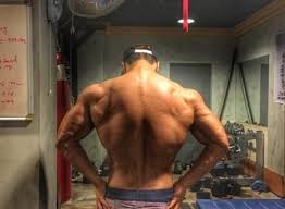 6 Inspirational People With Scoliosis You Should Have As Role Models Align Brace Scoliosis can also arise as a result of underlying medical conditions such as muscular dystrophy, cerebral palsy, and marfan syndrome. 6 inspirational people with scoliosis