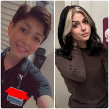 Hair Regrowth After Weight Loss Surgery