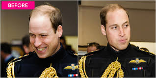 The no1 is the shortest you can go without opting for a fully shaved head. Prince William Gets Super Short Haircut Prince William S New Haircut