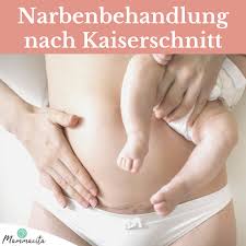 Ich bin jetzt genau nach einem jahr schwanger geworden und habe manchmal das gefühl es zerreist von innen. Narbenbehandlung Nach Kaiserschnitt Mammacita