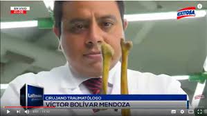Médico peruano hace trasplantes con huesos de difuntos |