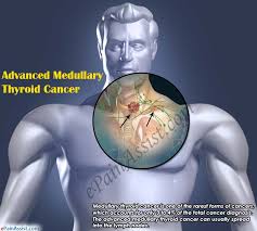 Some thyroid cancer symptoms include small, painless lumps in the front of the neck, hoarseness, and trouble swallowing. Advanced Medullary Thyroid Cancer Symptoms Treatment