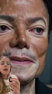 En este video te cuento qué le pasó a Michael Jackson y porqué su piel se  blanqueo por completo. . . . #drapascali #michaeljackson #vitiligo  #comoblanqueartupiel #pielblanca #blanqueatupiel