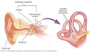 How long does a case of coronavirus last? Benign Paroxysmal Positional Vertigo Bppv Diagnosis And Treatment Mayo Clinic