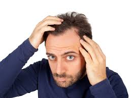 Bauman says that significant loss increases steadily with age: Putting The Handbrake On Hair Loss The Northern Daily Leader Tamworth Nsw