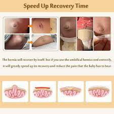 Maybe you would like to learn more about one of these? Buy Umbilical Hernia Belt Baby Belly Button Band Infant Newborn Belly Band Wrap Baby Abdominal Binder Umbilical Truss Cord Adjustable Navel Band Baby Online In Taiwan B07vvkz3lz